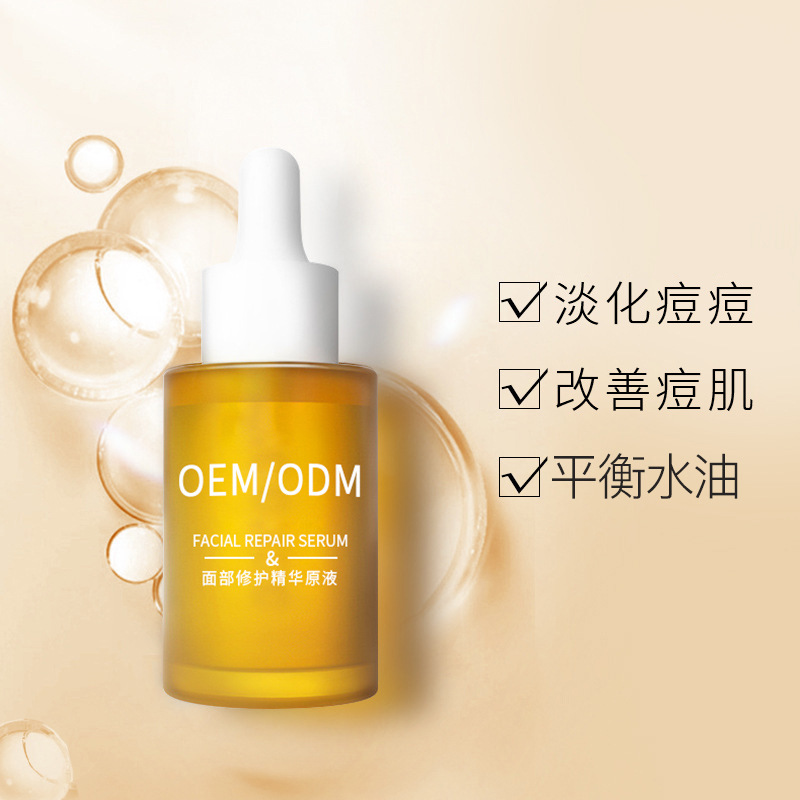 永州市_祛痘精华原液OEM